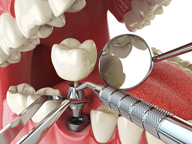 Best Emergency Denture Repair in Day Valley, CA