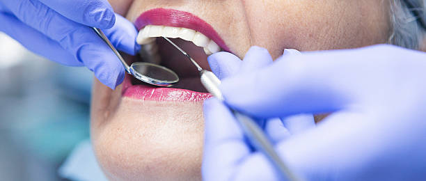 Best Broken or Chipped Tooth Repair in Day Valley, CA
